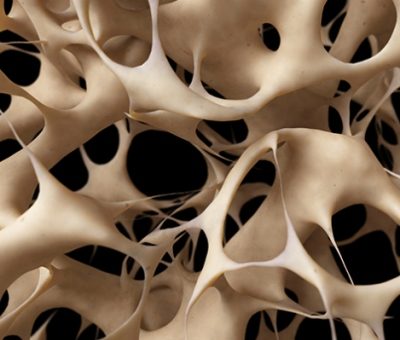 HGH and Osteoporosis