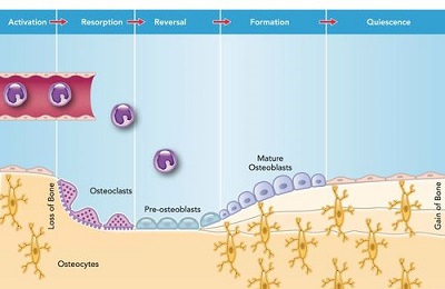 bone remodeling