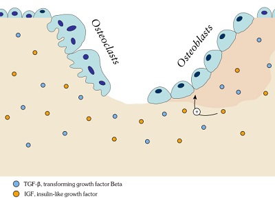 bone remodeling