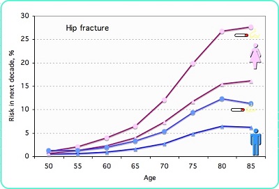 smoking bone fracture