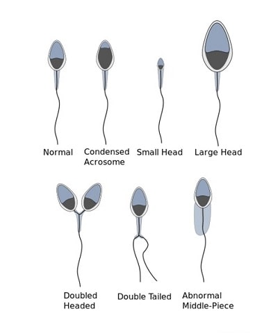 Sperm shapes