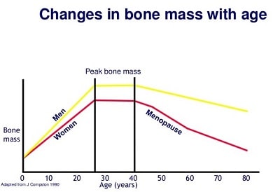 The Negative Health Effects of Testosterone Deficiency in Men - changes in bone mass with age