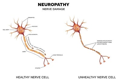 HGH and Recovery - Nerve Regeneration