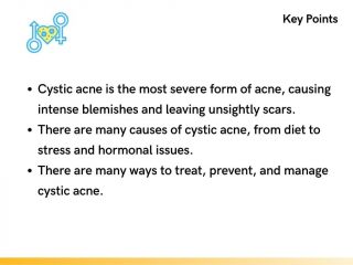 Key Points About Cystic Acne